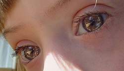 Na foto, o retrato fotogáfico, no detalhe dos olhos de uma criança com síndrome de Down